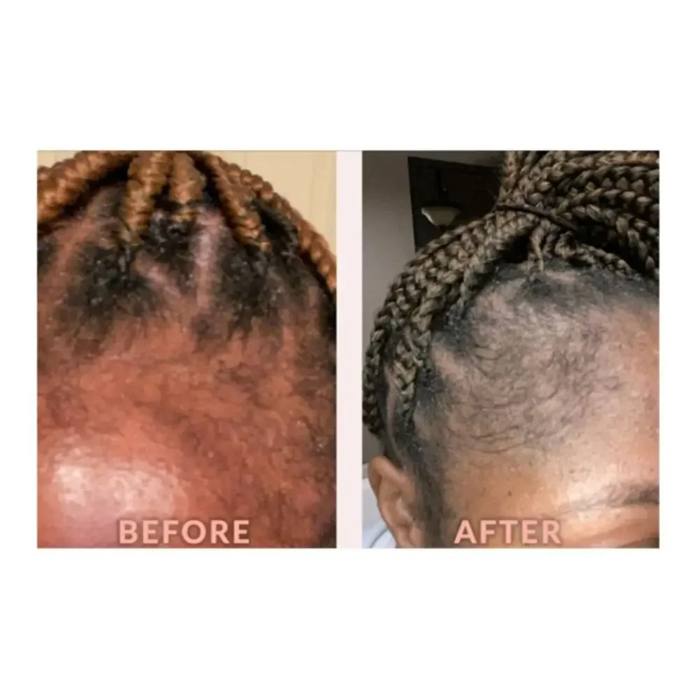 Design Essentials Edge & Temple Strengthening Hair Oil 4oz - X2